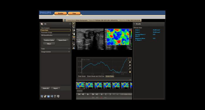 qlab software medical